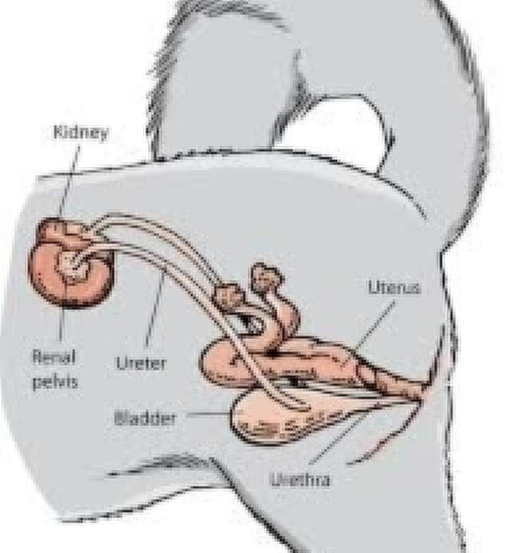 kidney placement