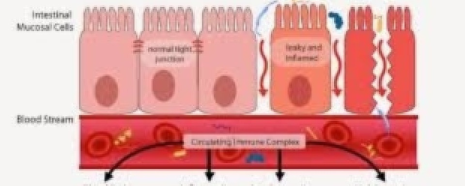 leaky gut