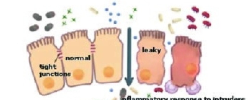 dysbiosis and leaky gut